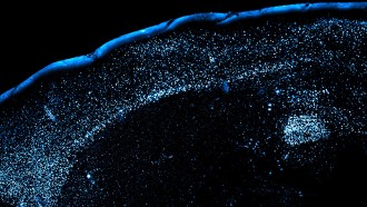Mouse brain region called the amygdala shown in blue after it encountered an unknown food