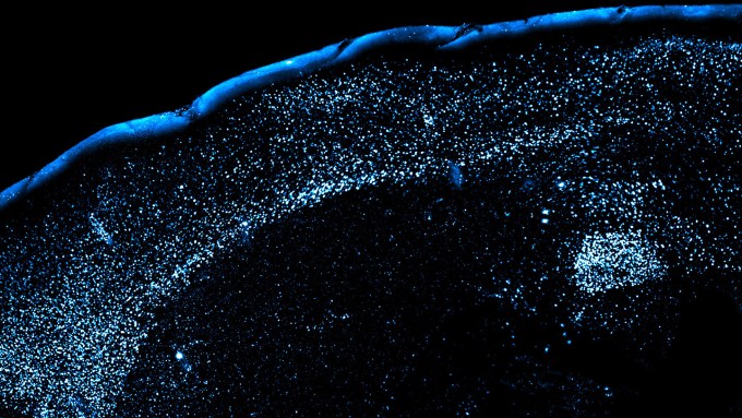 Mouse brain region called the amygdala shown in blue after it encountered an unknown food