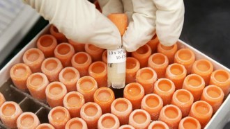 Vials of dopamine progenitor cells showing frozen cells that could be used for Parkinson's treatment