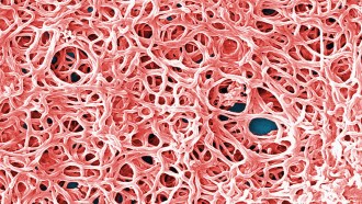 This pinkish image that looks a little like a pile of spaghetti is a tangle of the spiral-shaped bacteria that causes Lyme disease.